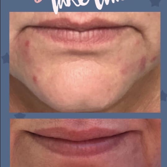 🌿BRAND NEW LUXURY SKINCARE🌿 - Picture 2 of 4